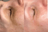 Flax-sculpt 5 skipti með 40% afslætti hjá Beauty Studio