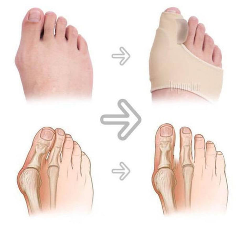 LS Foot Care Hallux Valgus Sokkur m/Púða