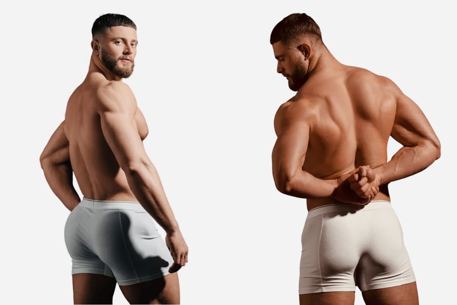 Brazilian butt lift (BBL) meðferð hjá Reykjavík Body Glow and Skin Clinic