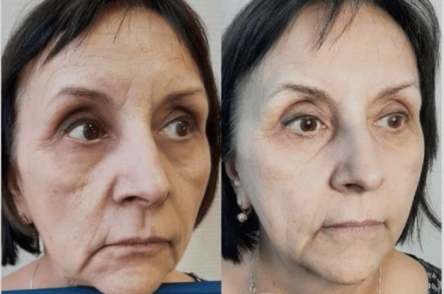 Flax-sculpt 5 skipti með 40% afslætti hjá Beauty Studio