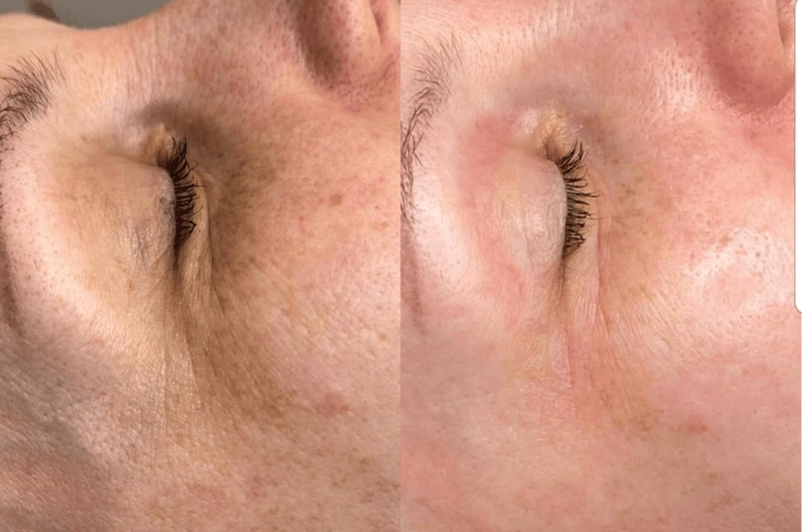 Flax-sculpt 5 skipti með 40% afslætti hjá Beauty Studio